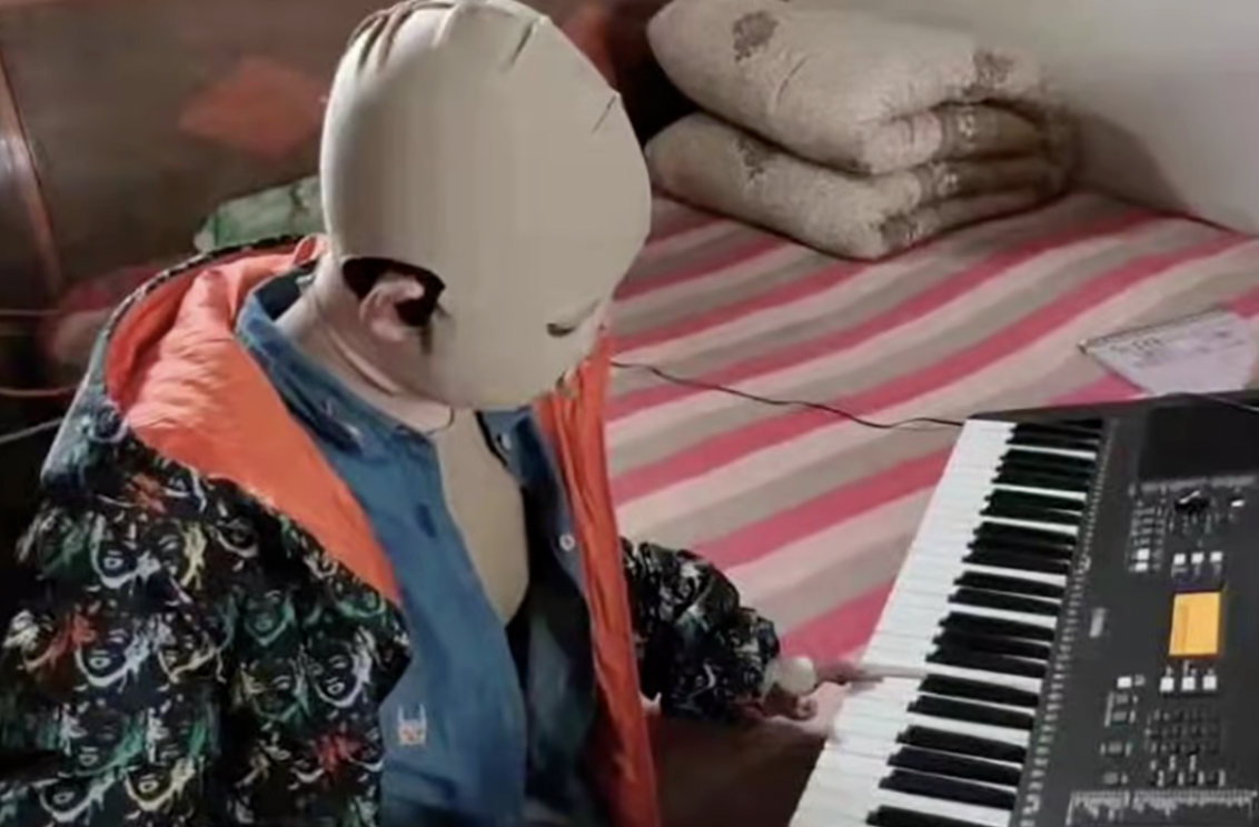 La Storia Di YuXin la bambina Cinese Ustionata Che E’ Tornata A Suonare