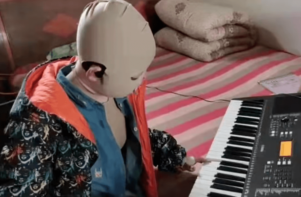 La Storia Di YuXin la bambina Cinese Ustionata Che E’ Tornata A&nbsp;Suonare